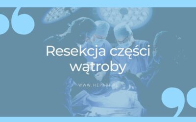 Resekcja części wątroby w leczeniu guzów wątroby